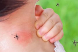 come tenere lontane le zanzare